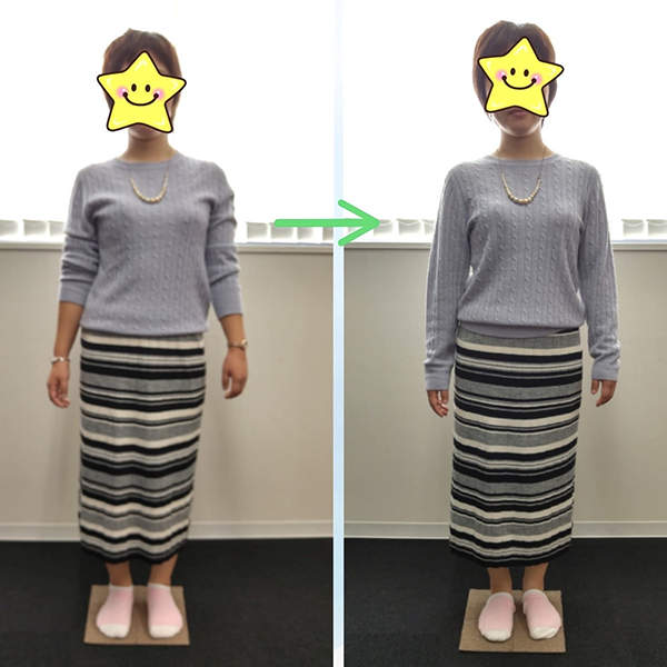 施術のビフォー&アフター